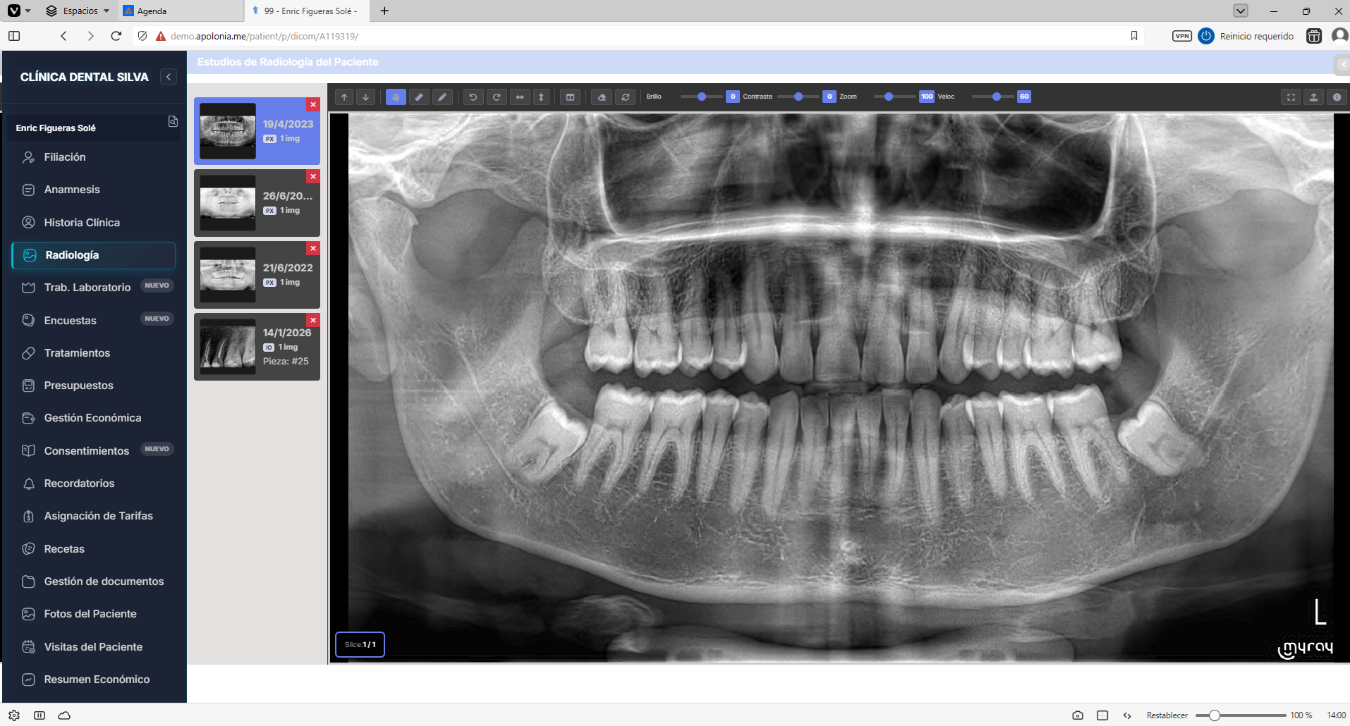 Software dental Apolonia - Dashboard de gestión completo para clínicas dentales con historia clínica digital