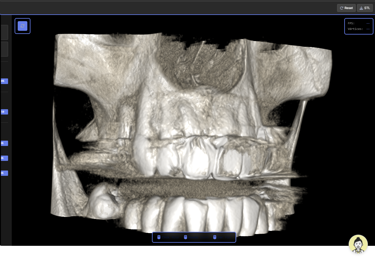 Visor DICOM con reconstrucción 3D y CBCT